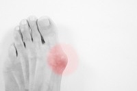 Gout Can Produce Extreme Pain